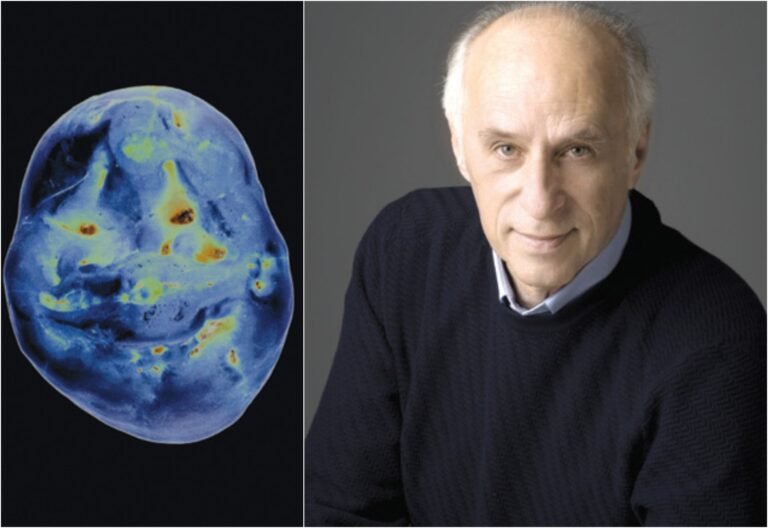 Durim Taçi: Mjeda i Zagrebit – “E bardha dhe e zeza mbeten të bukura”